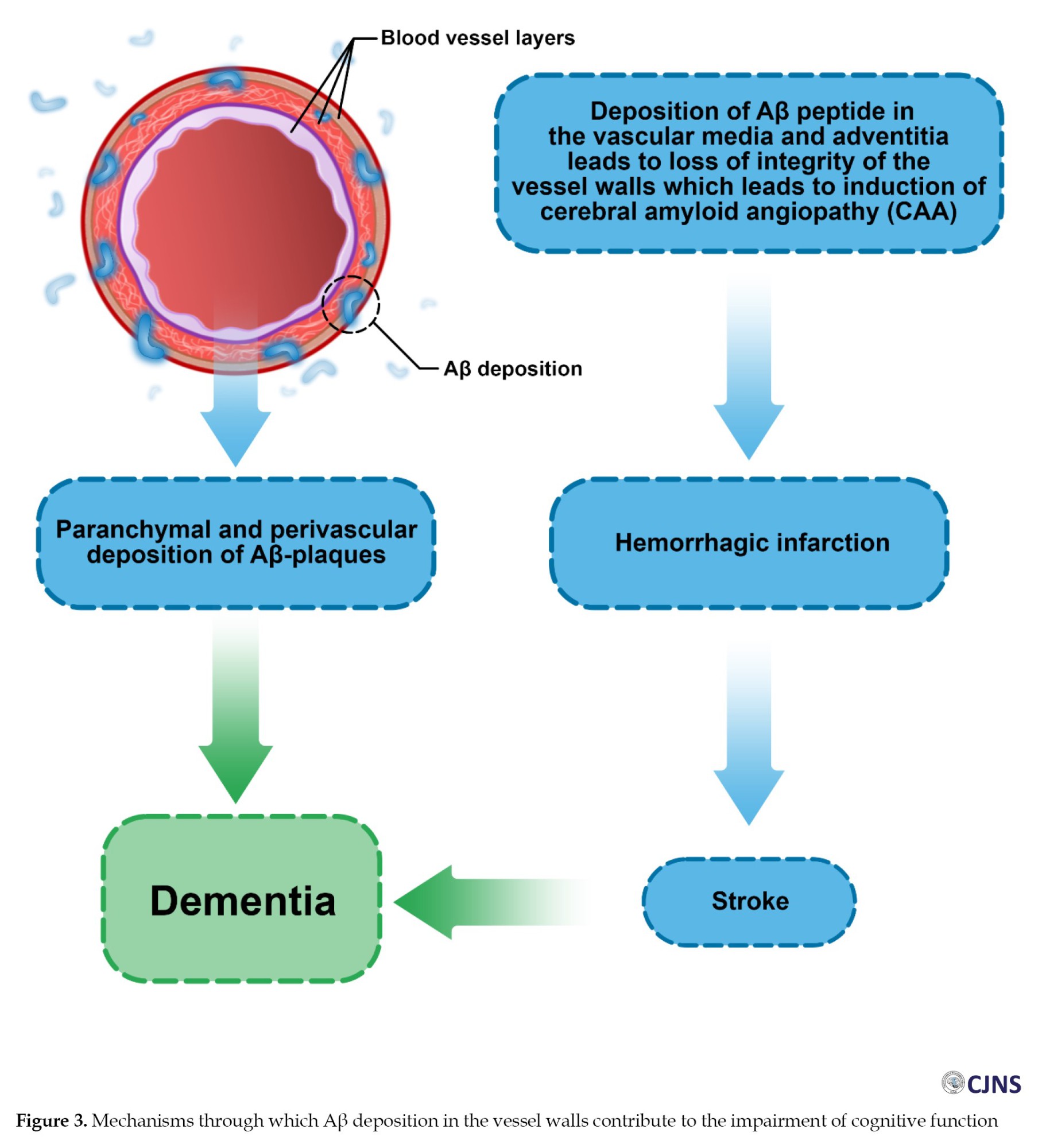 The Role of CSF Biomarkers in Discriminating Between